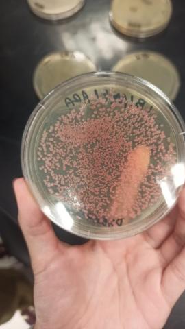 Cultura de bactérias transformadas